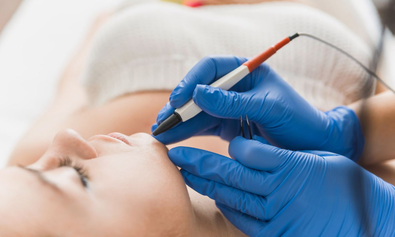 How Much Does Electrolysis Hair Removal Cost?