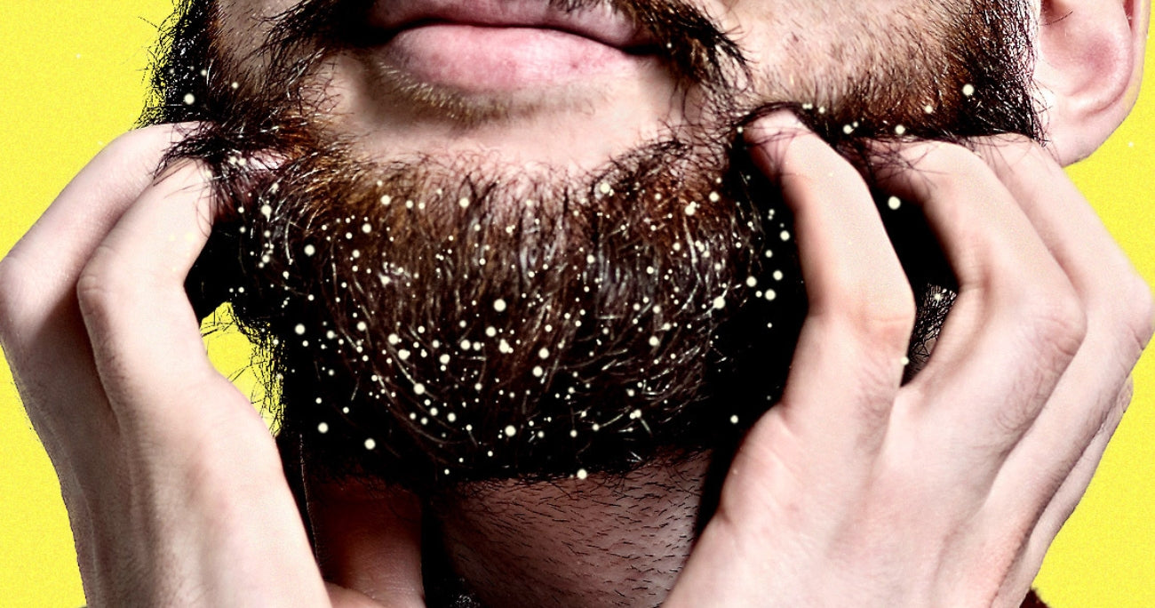 How to Get Rid of Beard Dandruff