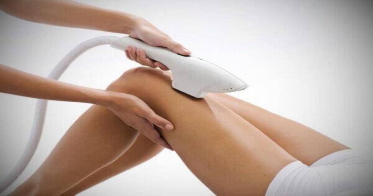 PhotoEpilation: Definition, Safety, Benefits, and, More