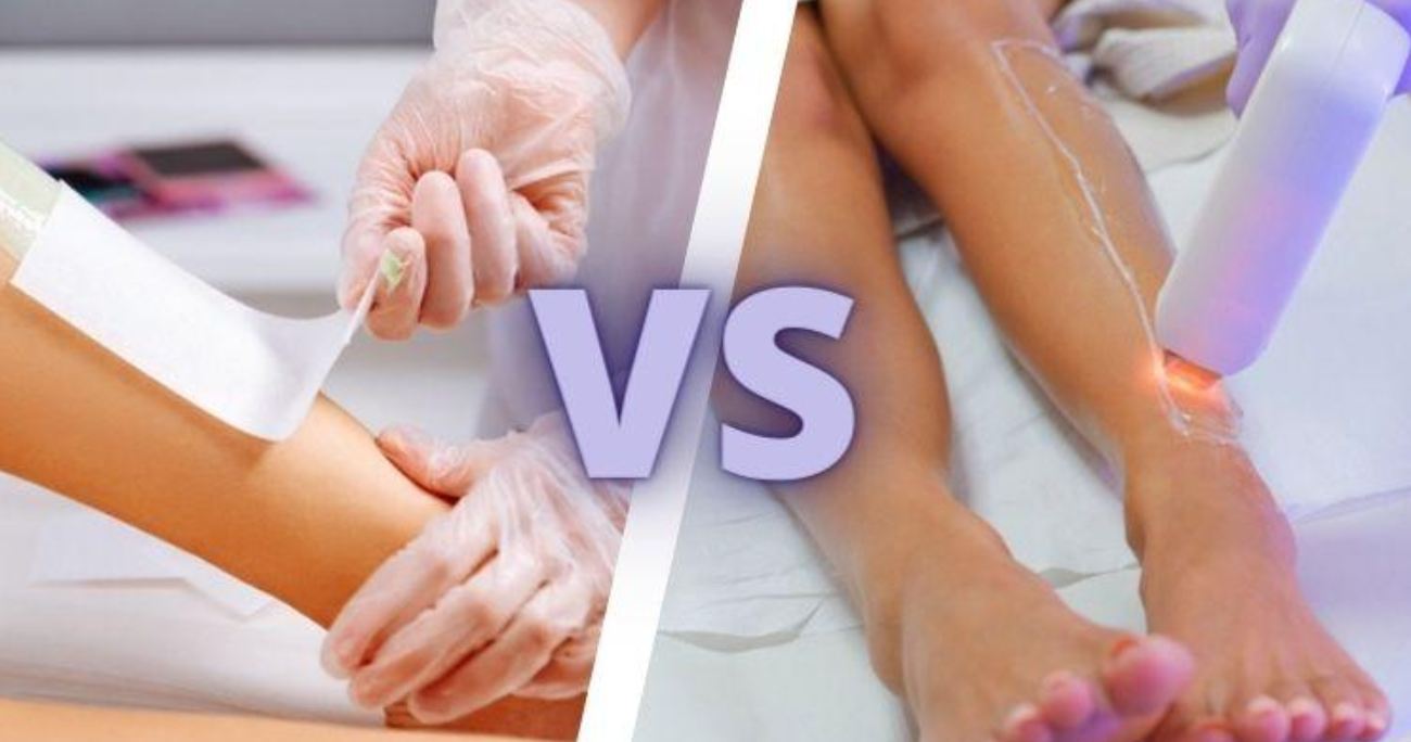 Waxing Vs. Laser Hair Removal