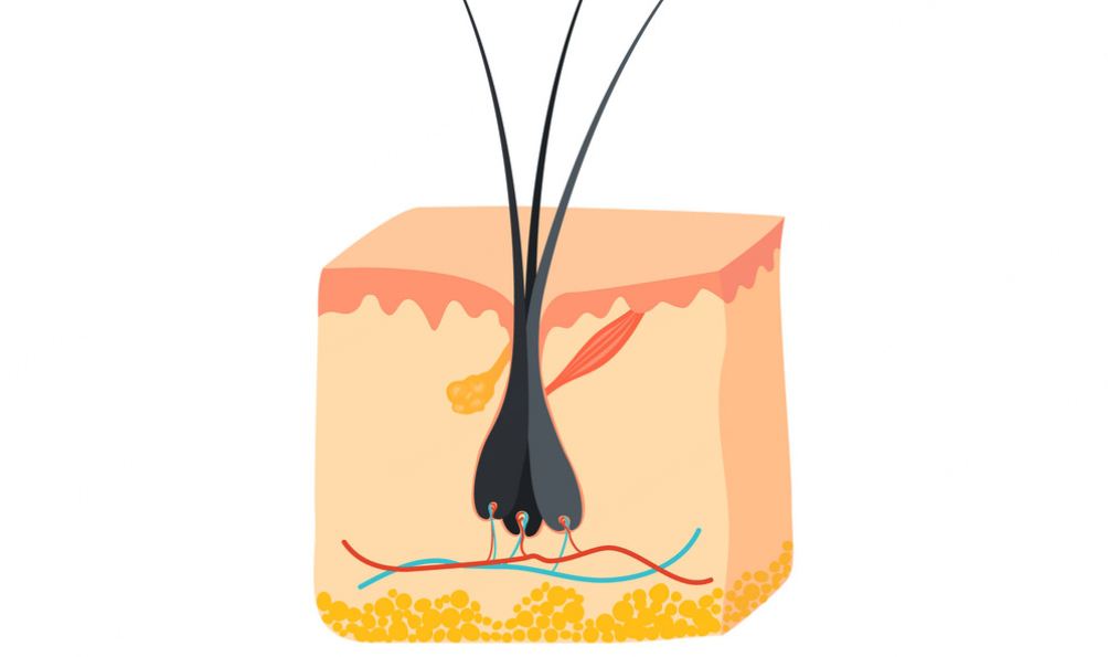 Why Are There Two Hairs in One Follicle: Causes, Removal Ways and FAQs