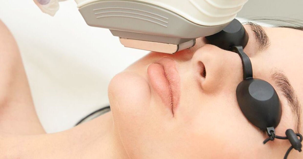 Laser Hair Removal for Face: Costs, Benefits, and FAQs