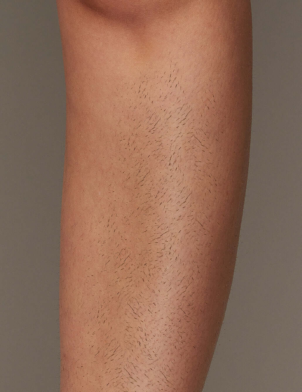 Effective IPL Hair Removal for Leg area with Ulike Air 