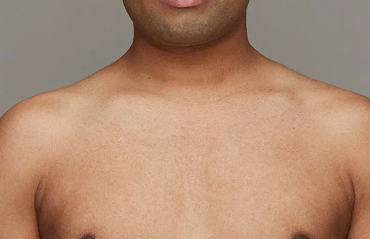 The effect of using ulike air 10 after chest hair removal